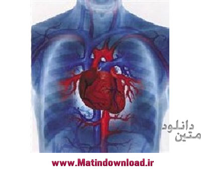 قلب مصنوعی - www.matindownload.ir